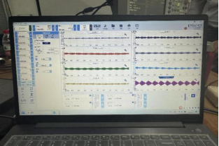 ATA-2021B功率放大器在超聲波測試的應用(圖10) ATA-2021B功率放大器在超聲波測試的應用(圖10)